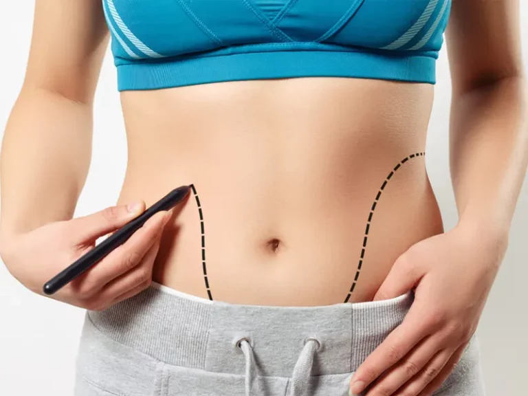 لیپوماتیک شکم و پهلو